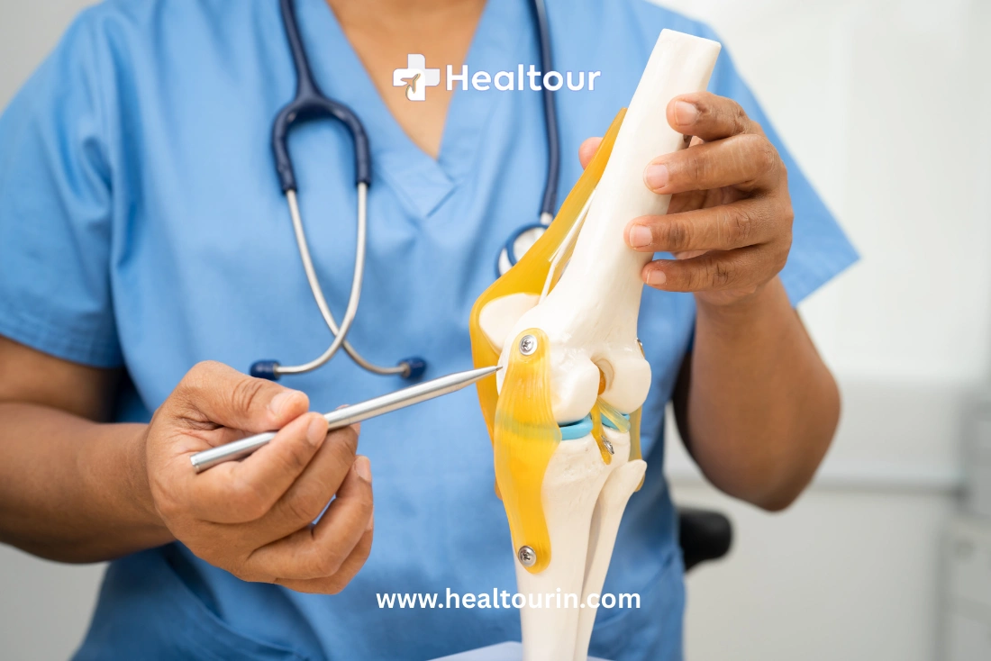 Cost of Knee Replacement Surgery in India 