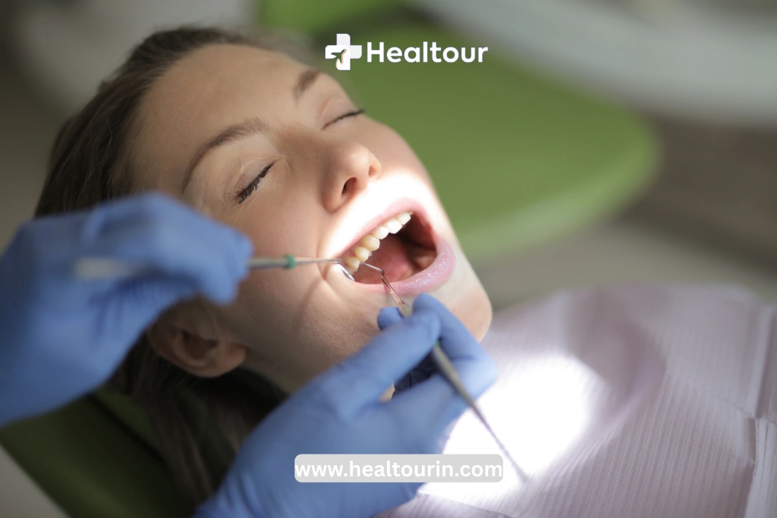 Cost of Dental Implants in India – Single Tooth Implant & Price 