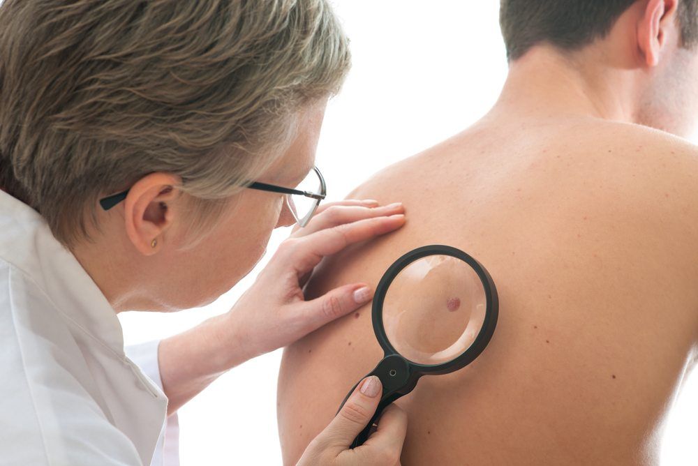Skin Cancer Treatment