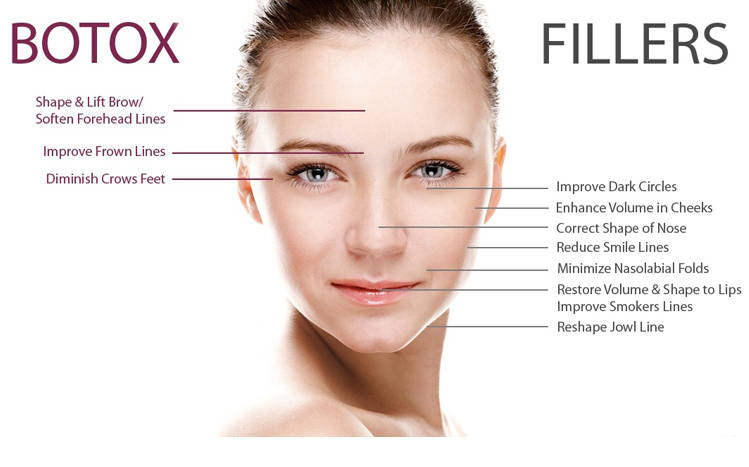 Botox & Fillers