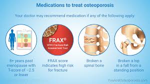 Osteoporosis Management