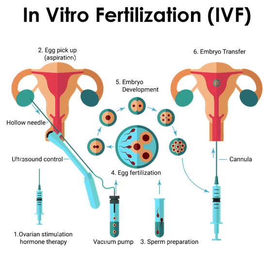 IVF & Infertility Treatments