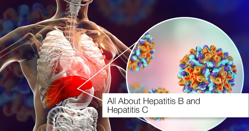 Hepatitis B and C Treatment
