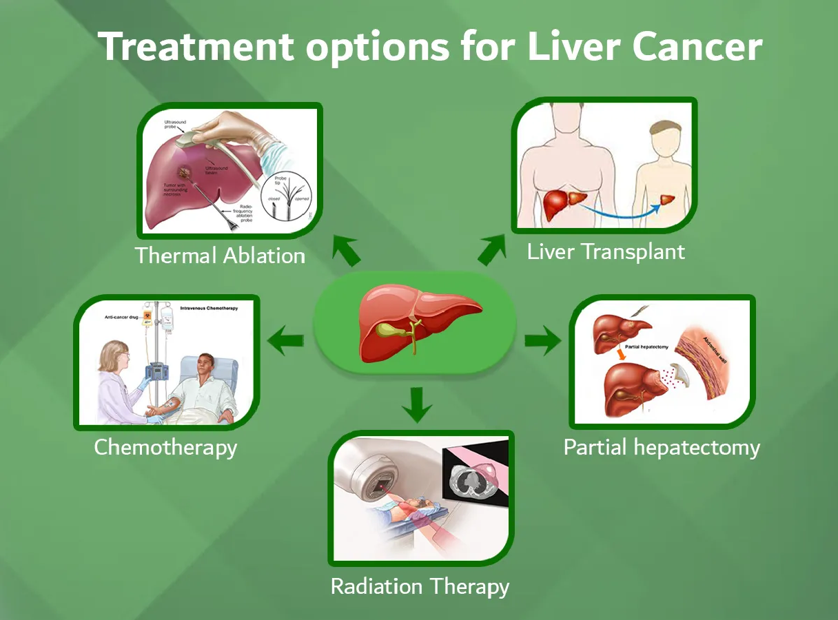Liver Cancer Treatment