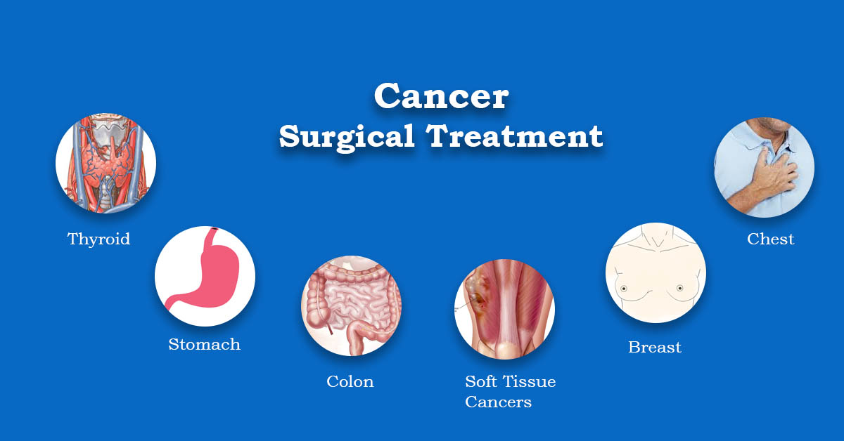 Cancer Surgery 