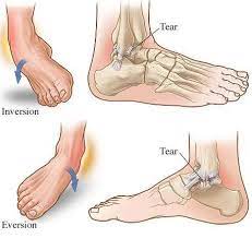 Sports Injuries Management