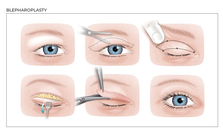 Aesthetic Surgery