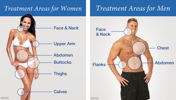Liposuction