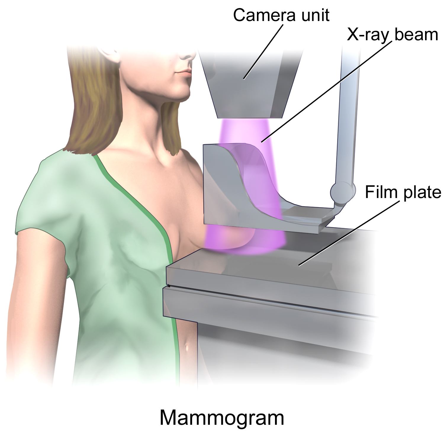 Mammography