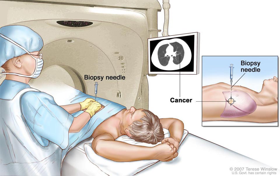Interventional Radiology 