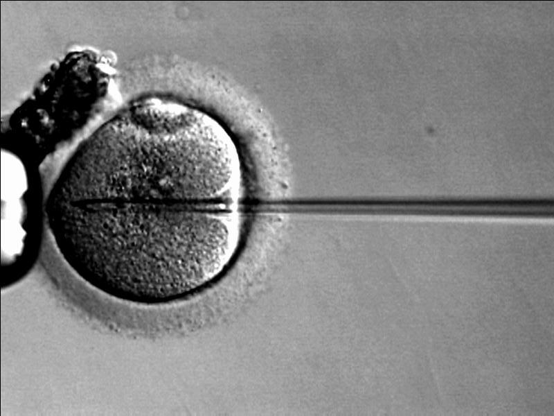 IntraCytoplasmic Sperm Injection(ICSI)
