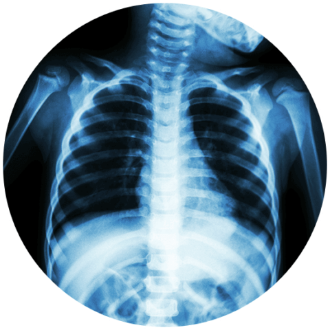 Spinal Issues Treatment