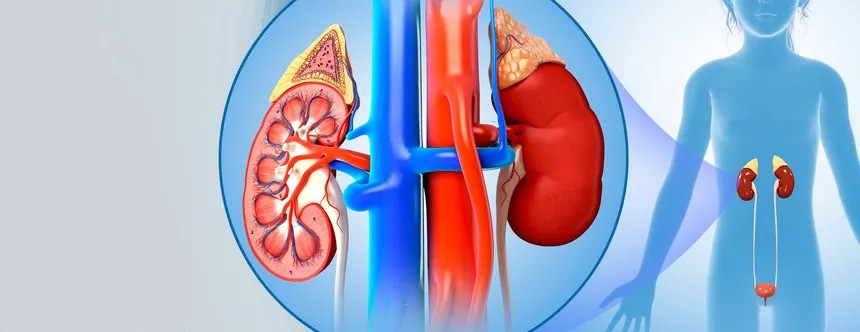 Pyeloplasty – for ureteropelvic junction obstruction