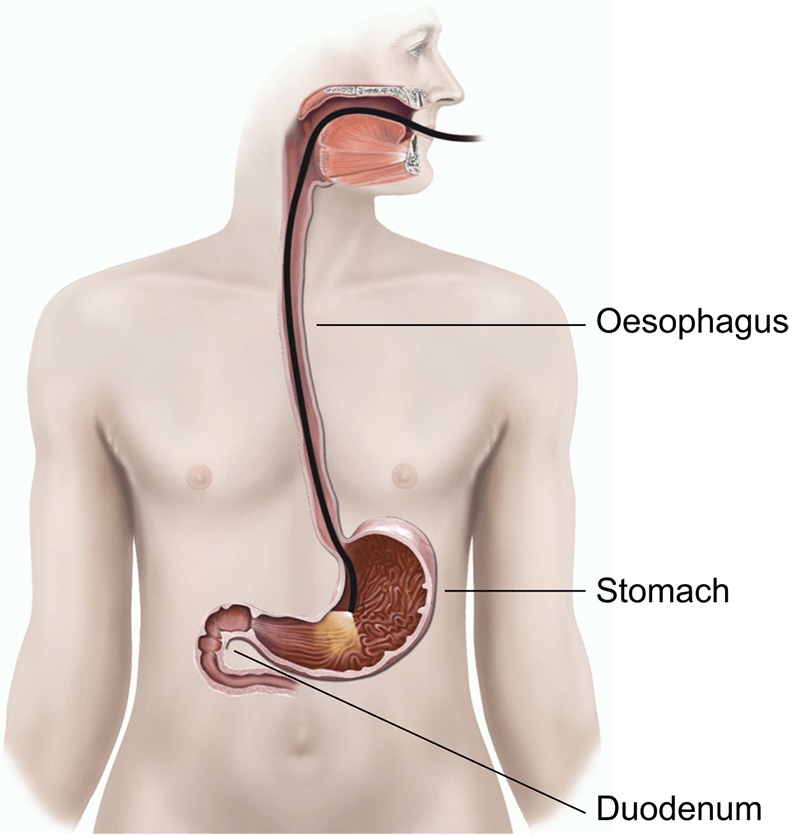 Colonoscopy & Endoscopy